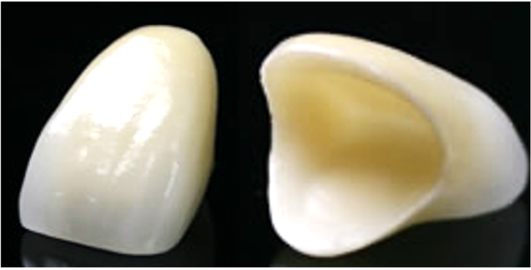 e-max